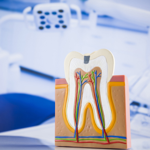 Best endodontist doctors in sahakarnagar, endodontic retreatment, endodontic surgery, endodontic treatment in sahakara nagar, endodontist in sahakara nagar, endodontist near sahakarnagar, painless root canal sahakara nagar