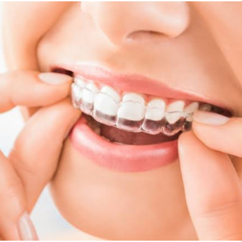 Invisalign aligners in sahakarnagar, invisalign braces in sahakara nagar, invisalign cost in sahakara nagar, invisalign price in sahakara nagar, invisalign provider in sahakara nagar