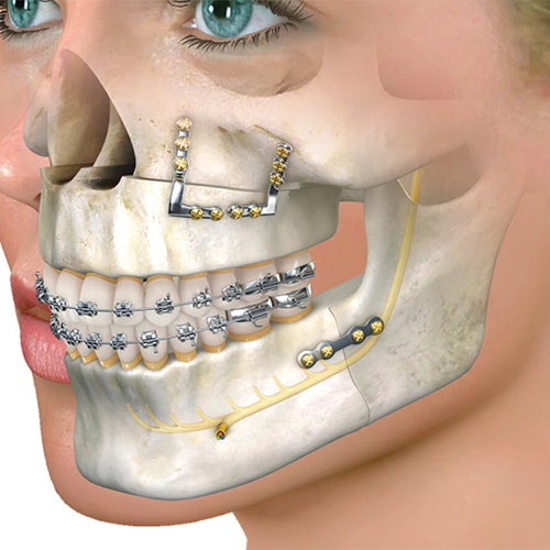 maxillofacial prosthesis treatment in sahakara nagar, maxillofacial prosthetics doctors in sahakar nagar, maxillofacial prosthetics in sahakara nagar, maxillofacial surgeon in sahakara nagar