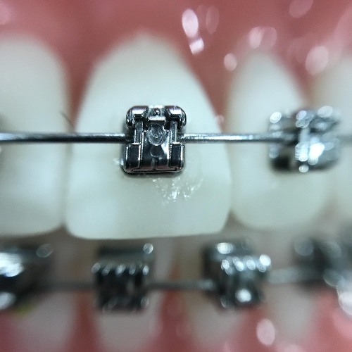 best orthodontic clinic, best orthodontic clinic in sahakara nagar, best orthodontic clinics in sahakara nagar, best orthodontic treatment in sahakara nagar, best orthodontist in sahakara nagar, best orthodontist sahakara nagar, orthodontic treatment in sahakara nagar, orthodontist near me, top orthodontist in sahakara nagar