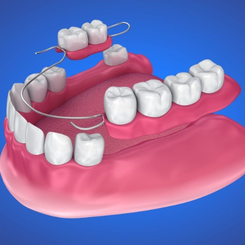 best prosthodontics clinic in sahakara nagar, prosthodontics specialist in sahakara nagar, prosthodontics treatment in sahakara nagar, prosthodontist doctor in sahakara nagar, prosthodontist in sahakara nagar