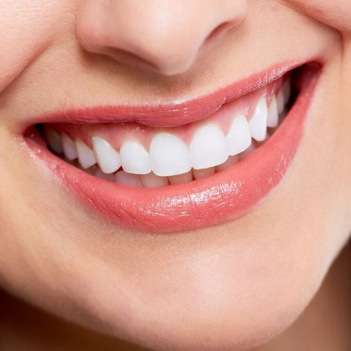 Smile Makeover, dental smile makeovers in sahakara nagar, digital smile design in sahakarnagar, smile makeover cost in sahakarnagar, smile makeover in sahakarnagar